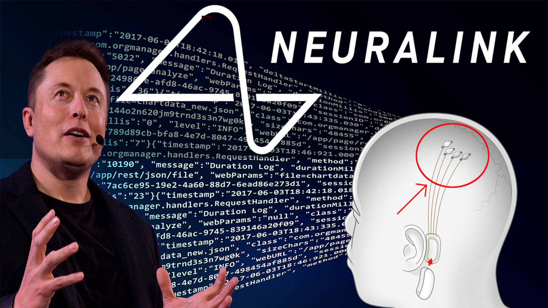Neuralink MAJOR Sign of the Times - تراشه مغزی نورالینک طی 10 سال زبان را منسوخ خواهد کرد